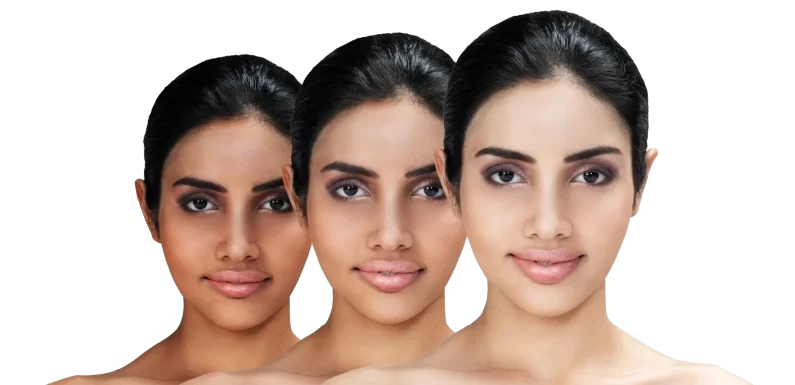 Achieve Brighter Skin with Innovative Skin Whitening Treatments for Radiant Beauty