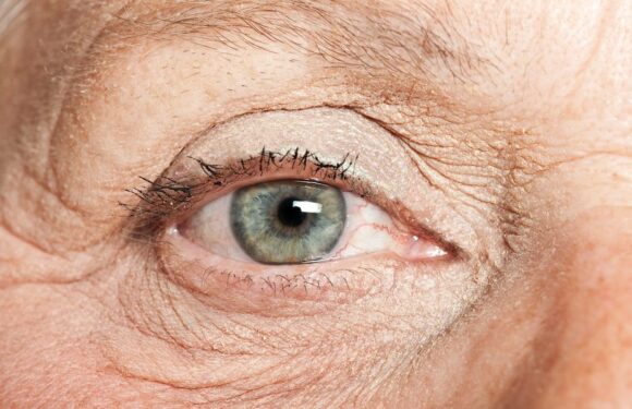 Link Between Aging and Macular Degeneration