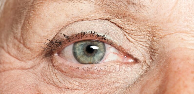 Link Between Aging and Macular Degeneration